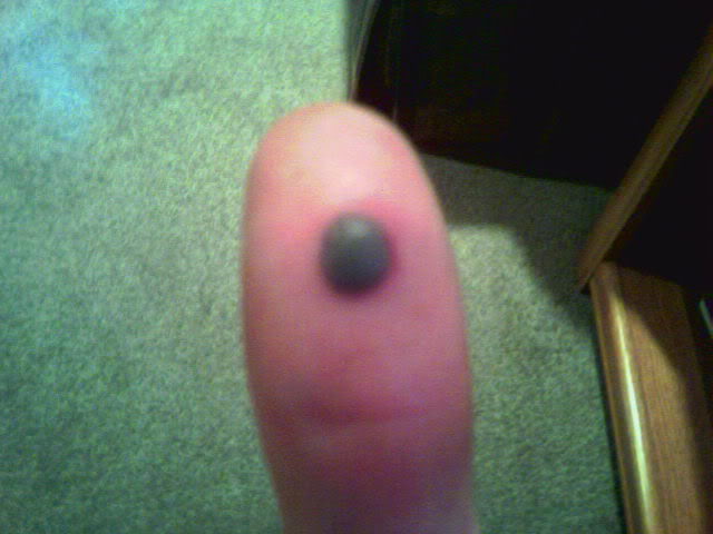 Name:  meanbloodblisterfromwork-1.jpg
Views: 4
Size:  36.7 KB